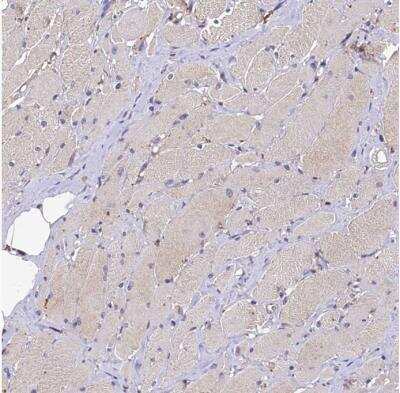 Immunohistochemistry-Paraffin: Plexin B1 Antibody [NBP1-87782]