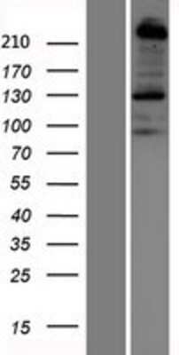 Western Blot: Plexin B1 Overexpression Lysate [NBP2-10842]