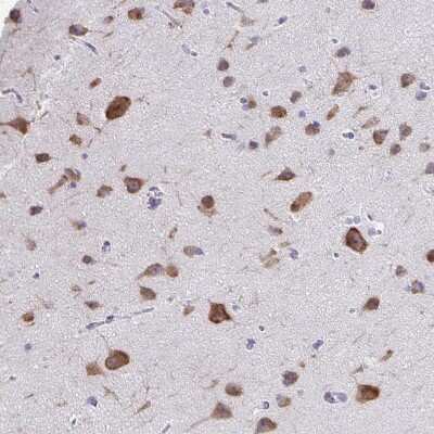 Immunohistochemistry-Paraffin: Plexin B3 Antibody [NBP2-38573]