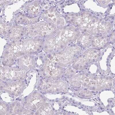 Immunohistochemistry-Paraffin: Plexin B3 Antibody [NBP2-38573]