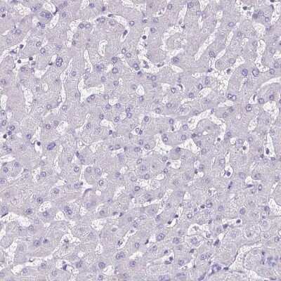 Immunohistochemistry-Paraffin: Plexin B3 Antibody [NBP2-38573]