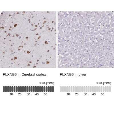 Immunohistochemistry-Paraffin: Plexin B3 Antibody [NBP2-38573]