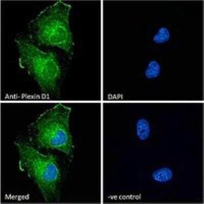 Immunocytochemistry/ Immunofluorescence: Plexin D1 Antibody [NB300-961]