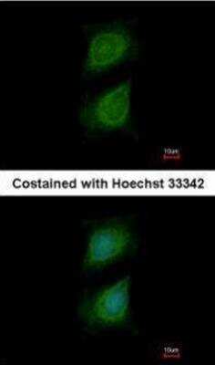 Immunocytochemistry/ Immunofluorescence: Plexin D1 Antibody [NBP1-33634]