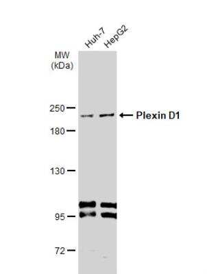 Western Blot: Plexin D1 Antibody [NBP1-33634]