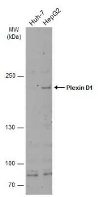 Western Blot: Plexin D1 Antibody [NBP3-12915]