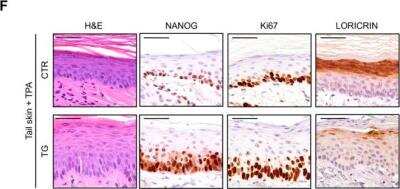 Immunohistochemistry: Pluripotent Stem Cell Transcription Factor Antibody Pack [NBP1-42823]
