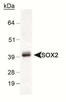 Western Blot: Pluripotent Stem Cell Transcription Factor Antibody Pack [NBP1-42823]