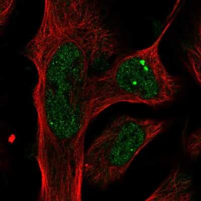 Immunocytochemistry/ Immunofluorescence: Plxdc2 Antibody [NBP1-92278]