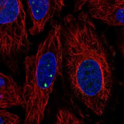 Immunocytochemistry/ Immunofluorescence: Plxdc2 Antibody [NBP2-57837]