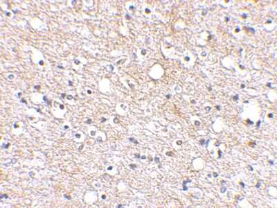Immunohistochemistry-Paraffin: Plxdc2 Antibody - BSA Free [NBP1-76858]