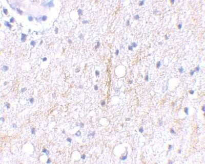 Immunohistochemistry-Paraffin: Plxdc2 Antibody - BSA Free [NBP1-76859]