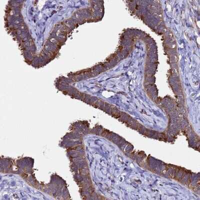 Immunohistochemistry-Paraffin: Plxdc2 Antibody [NBP1-92278]