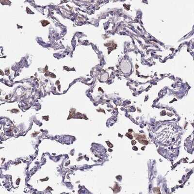 Immunohistochemistry-Paraffin: Plxdc2 Antibody [NBP1-92278]