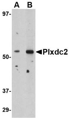 Western Blot: Plxdc2 AntibodyBSA Free [NBP1-76858]
