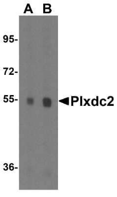 Western Blot: Plxdc2 AntibodyBSA Free [NBP1-76858]