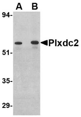 Western Blot: Plxdc2 AntibodyBSA Free [NBP1-76859]