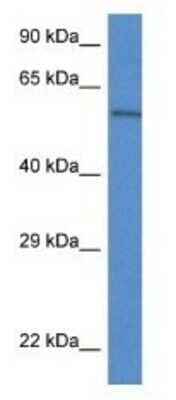 Western Blot: Plxdc2 Antibody [NBP1-79337]