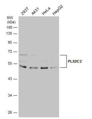 Western Blot: Plxdc2 Antibody [NBP2-19869]