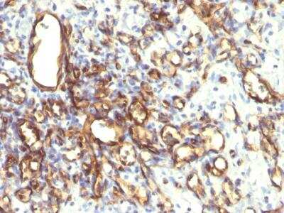 Immunohistochemistry-Paraffin: Podocalyxin Like Antibody (2A4) - IHC-Prediluted [NBP2-48344]