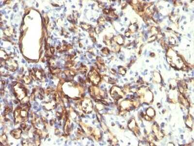 Immunohistochemistry-Paraffin: Podocalyxin Like Antibody (2A4) [NBP2-45169]