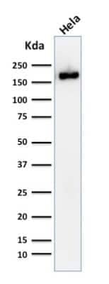 Western Blot: Podocalyxin Like Antibody (2A4) [NBP2-45169]