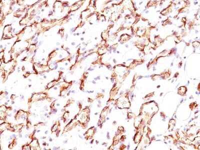 Immunohistochemistry-Paraffin: Podocalyxin Like Antibody (3D3) - Azide and BSA Free [NBP2-33108]