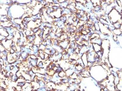 Immunohistochemistry-Paraffin: Podocalyxin Like Antibody (3D3) - IHC-Prediluted [NBP2-45167]