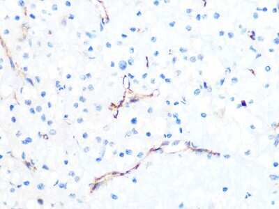 Immunohistochemistry-Paraffin: Podocalyxin Like Antibody (6S9A9) [NBP3-16434]
