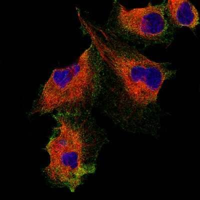 Immunocytochemistry/ Immunofluorescence: Podocalyxin Like Antibody (CL0284) [NBP2-52903]