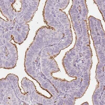 Immunohistochemistry-Paraffin: Podocalyxin Like Antibody (CL0284) [NBP2-52903]