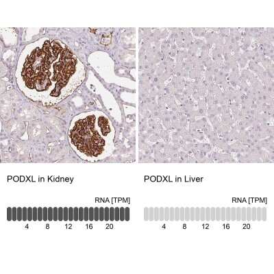Immunohistochemistry-Paraffin: Podocalyxin Like Antibody (CL0284) [NBP2-52903]