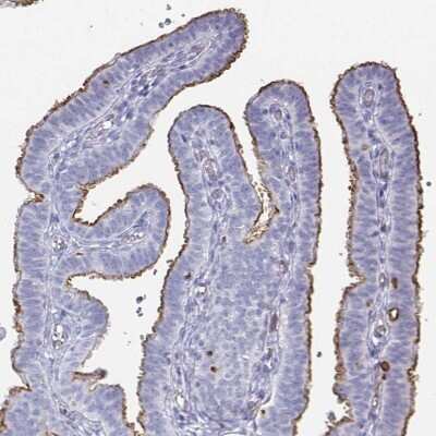 Immunohistochemistry-Paraffin: Podocalyxin Like Antibody (CL0308) [NBP2-52912]