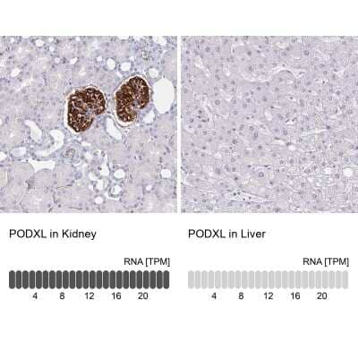 Immunohistochemistry-Paraffin: Podocalyxin Like Antibody (CL0308) [NBP2-52912]