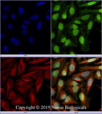 Immunocytochemistry/ Immunofluorescence: Podocalyxin Like Antibody [NB110-41503]