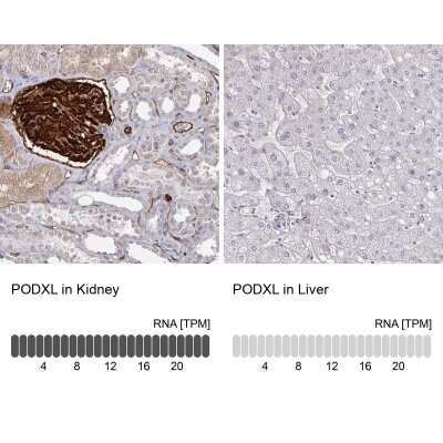 Immunohistochemistry-Paraffin: Podocalyxin Like Antibody [NBP1-83348]