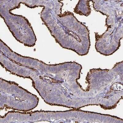 Immunohistochemistry-Paraffin: Podocalyxin Like Antibody [NBP1-83348]