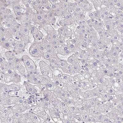 Immunohistochemistry-Paraffin: Podocalyxin Like Antibody [NBP1-83348]