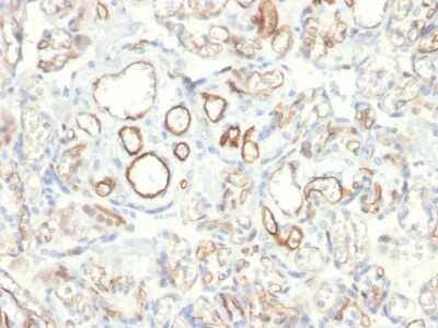 Immunohistochemistry-Paraffin: Podocalyxin Like Antibody (PODXL/2185) [NBP2-79749]