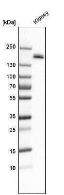 Western Blot: Podocalyxin Like Antibody [NBP1-83348]