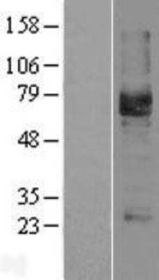 Western Blot: Podocalyxin Like Overexpression Lysate [NBL1-14562]