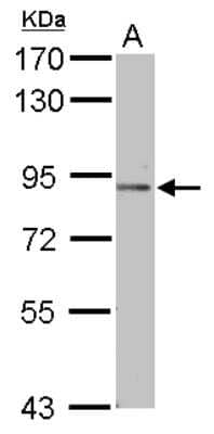 Western Blot: Podocan Antibody [NBP2-19881]