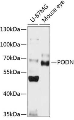 Western Blot: Podocan AntibodyBSA Free [NBP2-93238]