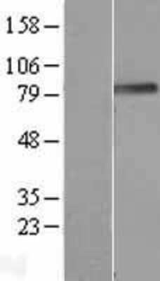 Western Blot: Podocan Overexpression Lysate [NBL1-14560]