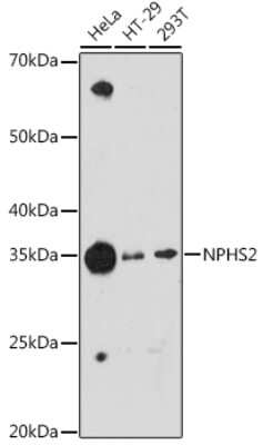 Western Blot: Podocin/NPHS2 Antibody (2O10G3) [NBP3-16111]