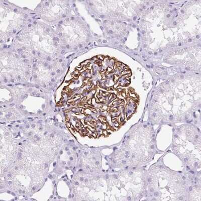 Immunohistochemistry-Paraffin: Podocin/NPHS2 Antibody [NBP2-33570]