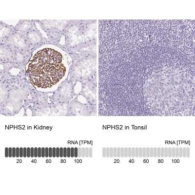 Immunohistochemistry-Paraffin: Podocin/NPHS2 Antibody [NBP2-33570]