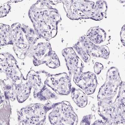 Immunohistochemistry-Paraffin: Podocin/NPHS2 Antibody [NBP2-33570]
