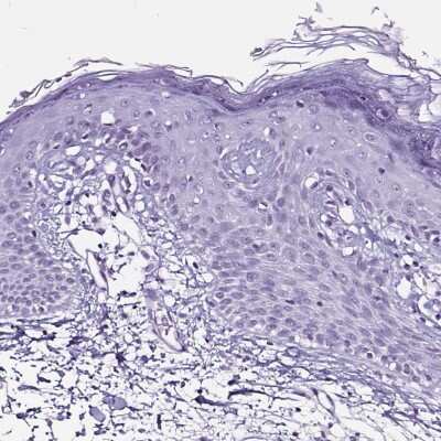 Immunohistochemistry-Paraffin: Podocin/NPHS2 Antibody [NBP2-33570]