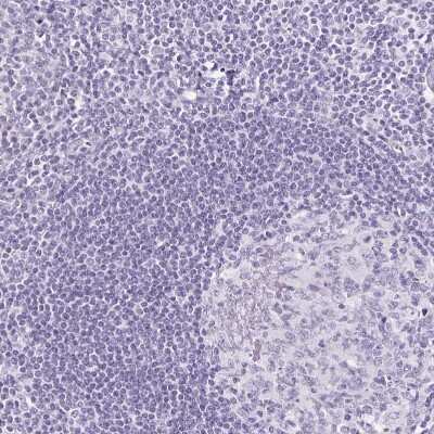 Immunohistochemistry-Paraffin: Podocin/NPHS2 Antibody [NBP2-33570]